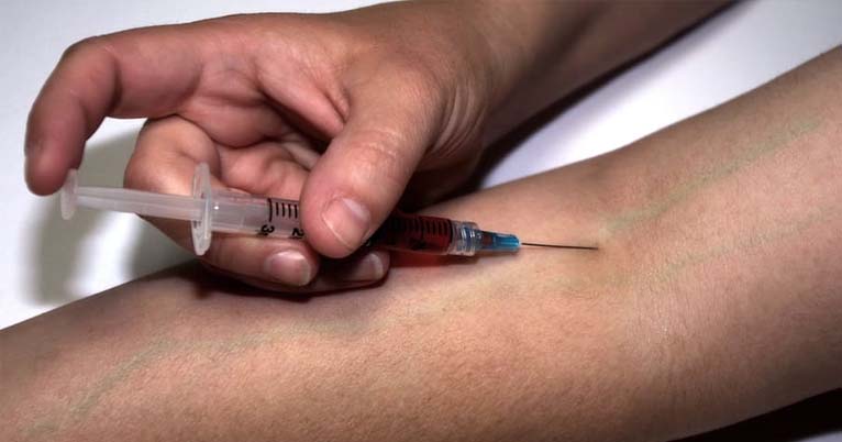 Close-up of a hand depressing the plunger on a needle injecting a drug into a man's forearm.