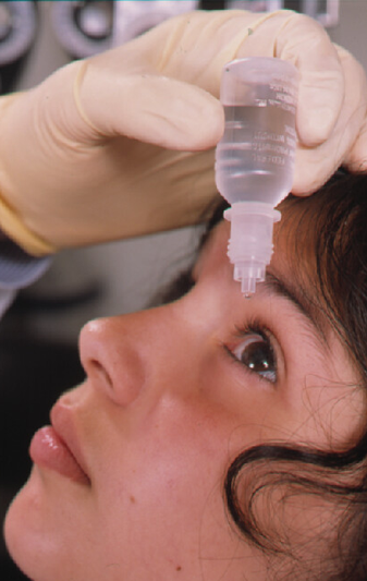 Squeezing eyedrops into the eye
