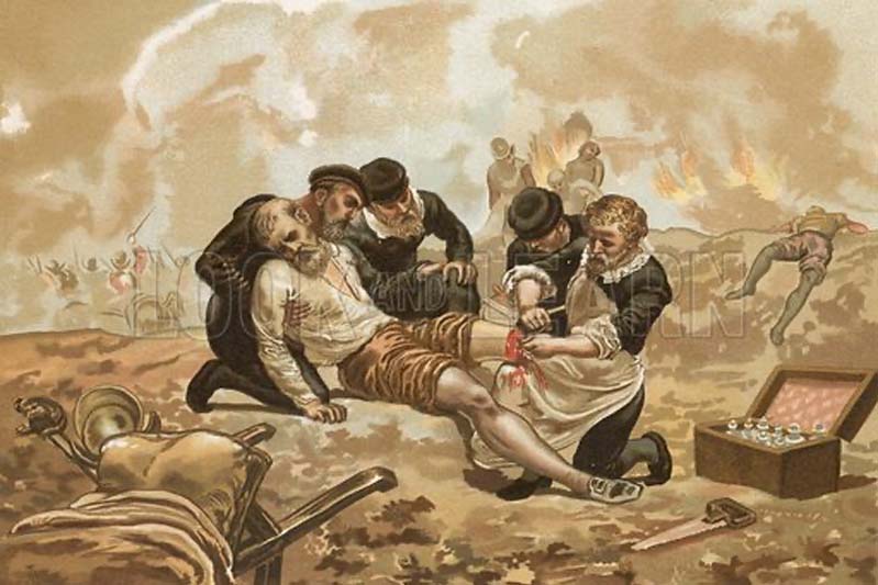Large chromolithograph of a soldier getting his leg cut off.