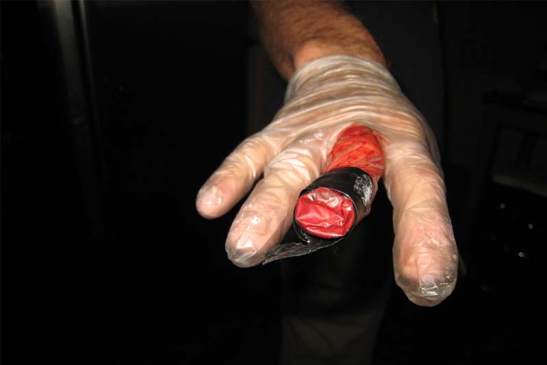 A hand in a plastic glove with black electrical tape wrapped around the outside of one gloved finger on a black background.